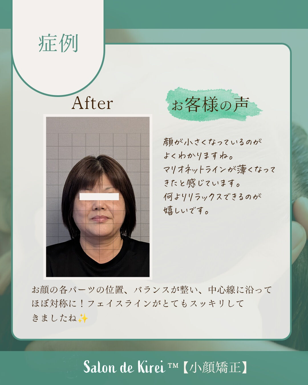 【岡山 倉敷市】リフトアップ・たるみ改善特化/40代からはじ