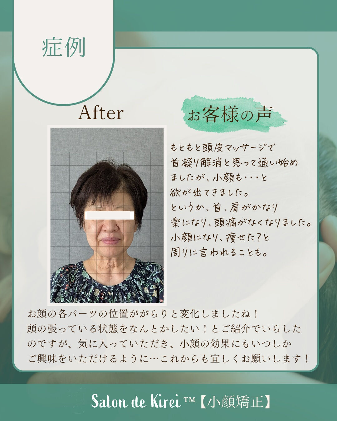 【岡山 倉敷市】リフトアップ・たるみ改善特化/40代からはじ